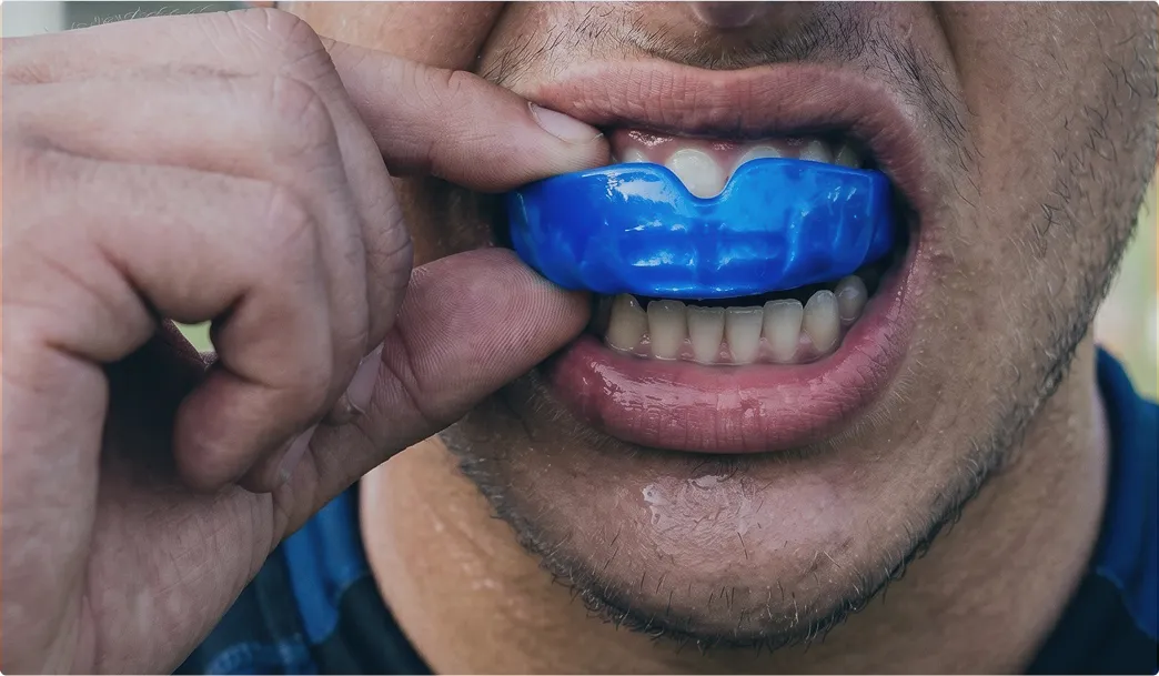 スポーツマウスガードを装着する様子
